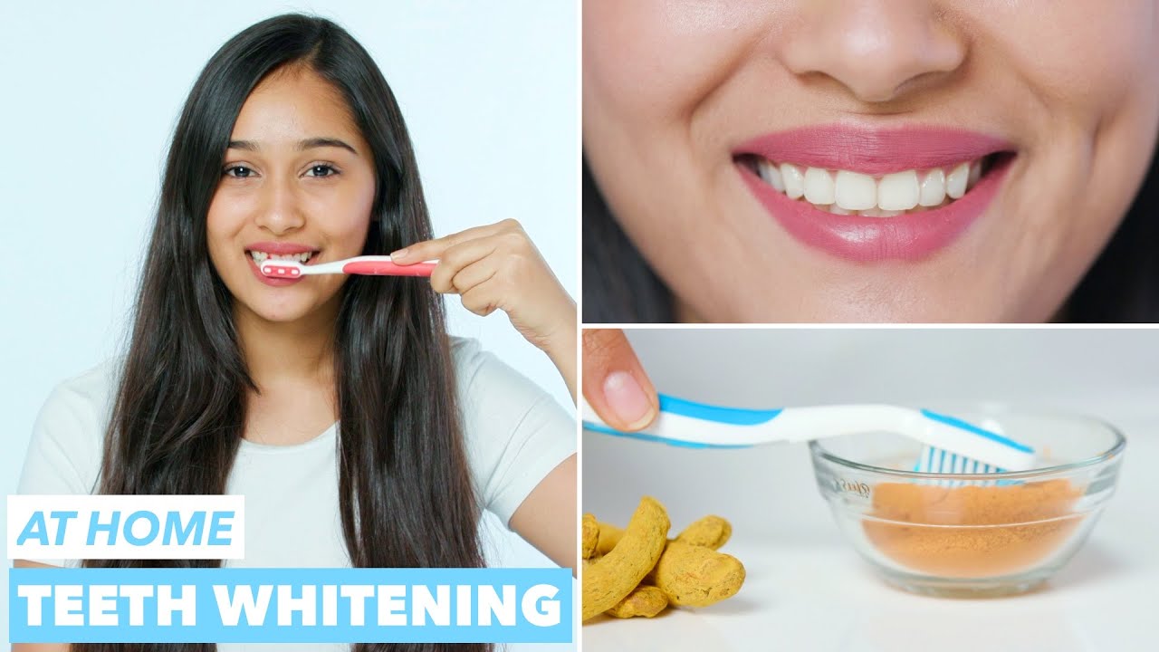 Best teeth whitening tips to make teeth white quickly at home